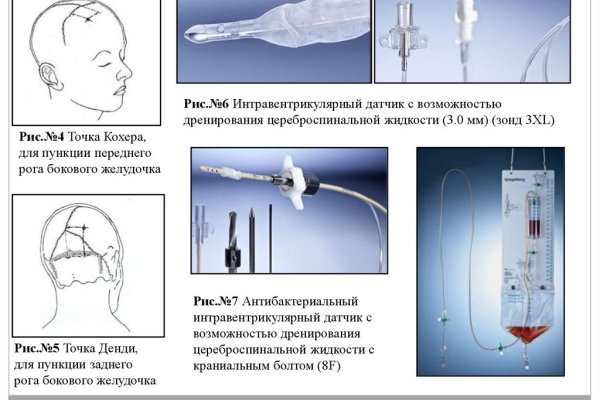 Кракена точка нет